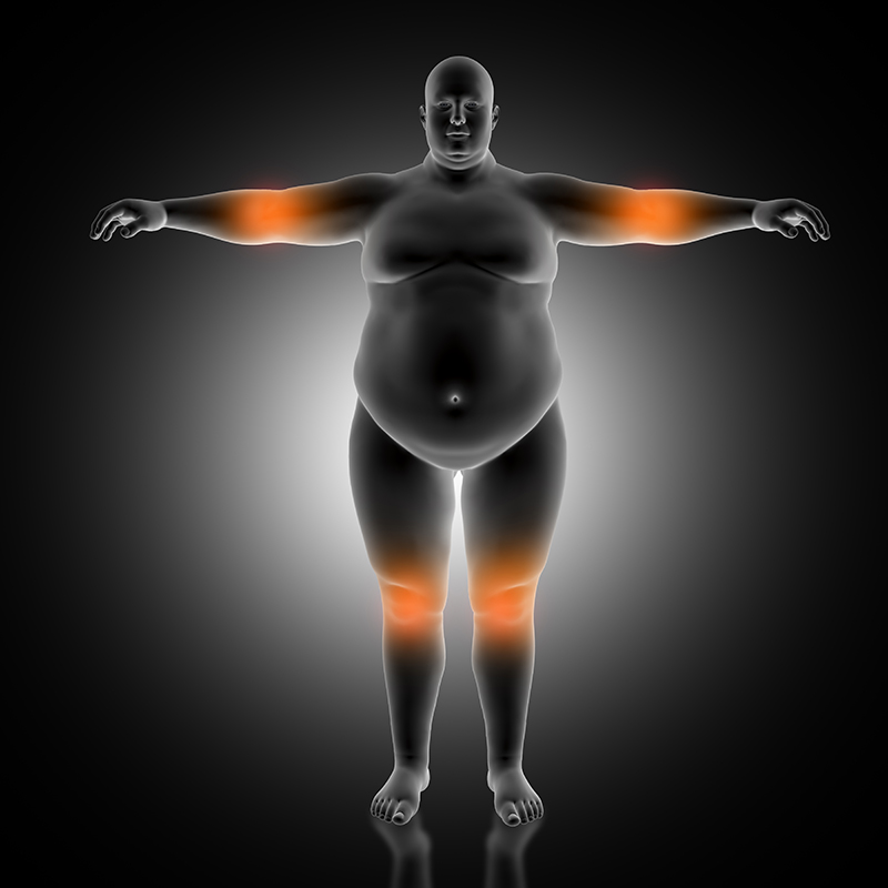 3D render of a medical background of overweight male with elbow and knees highlighted